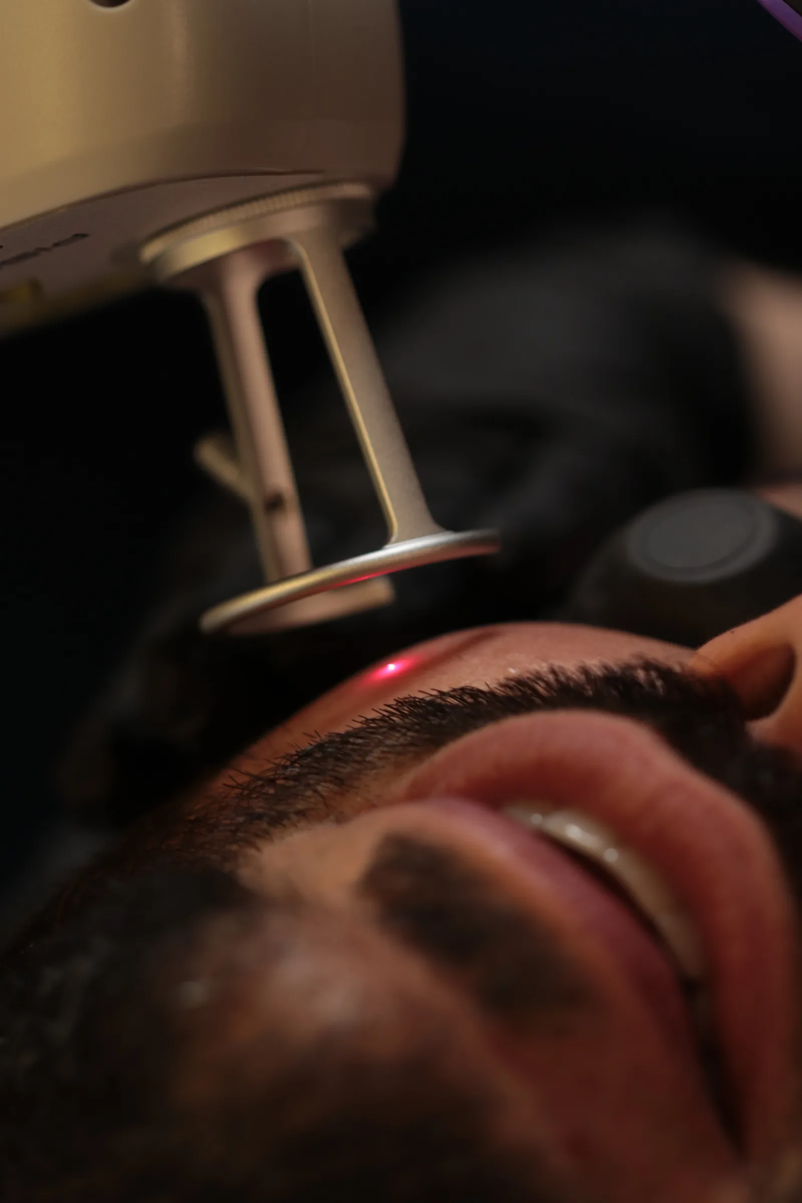Aplicação de laser com mira vermelha visível durante sessão na MYL